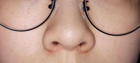 겉으로 만지거나 봤을땐 멀쩡한데.... 어릴 때 로션이나 스킨을 안발라서 그런가