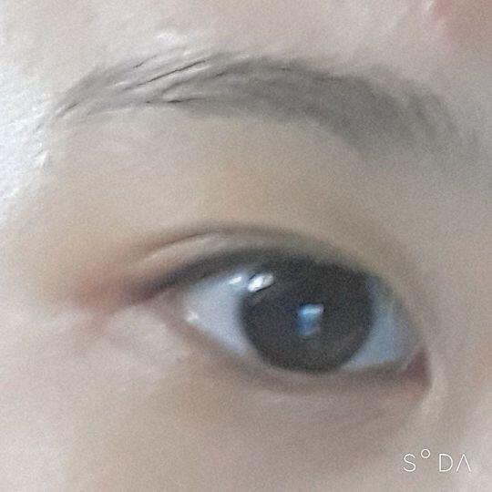 이게 내눈이야