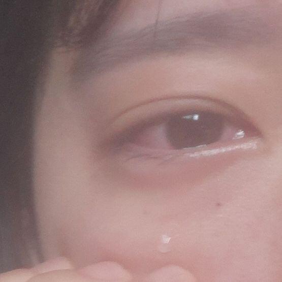 쌍꺼풀터지겠다 ㅜㅜ