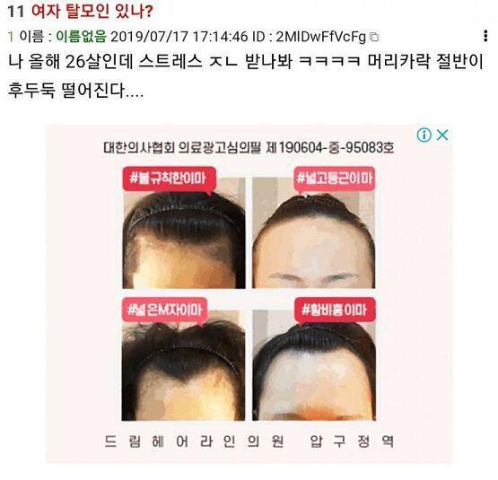 광고가 기가막히누