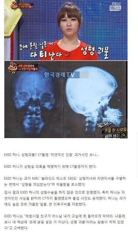 왕따까지는 아니더라도 EXID 하니도 어느날 반 친구가 교실에 못 들어가게 막길래 자기 자리 가 봤더니 '성형 괴물' '코에 분필 넣은 거 티