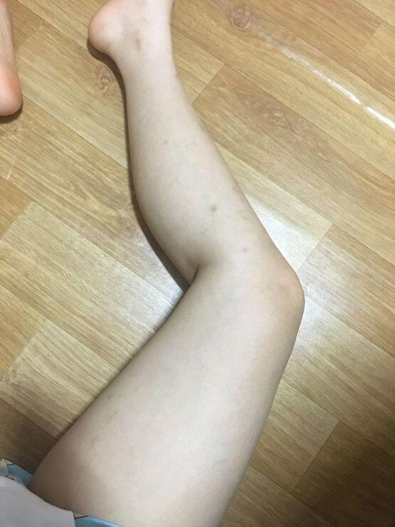 사진이야
