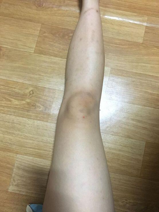 사진이야