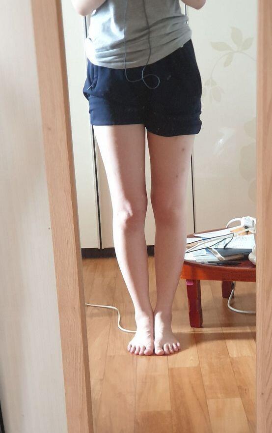 ㆍ