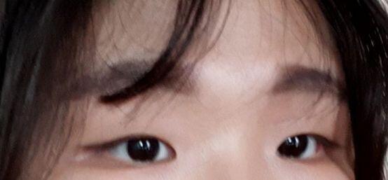 진짜 밋밋하게 생겼다 나.. 쌍수할까