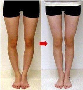 보통사람도 어느정도 다리가 휠 수는 있어 거울앞에 서서 이 포즈로 확인해봐