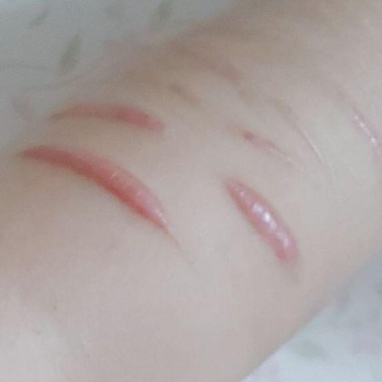 켈로이드랑 결 생긴 부분 착색 사진이야 좀 혐오스러우니까 이런 거 못 보는 사람은 안 봤으면 좋겠어