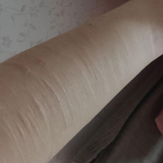 켈로이드랑 결 생긴 부분 착색 사진이야 좀 혐오스러우니까 이런 거 못 보는 사람은 안 봤으면 좋겠어