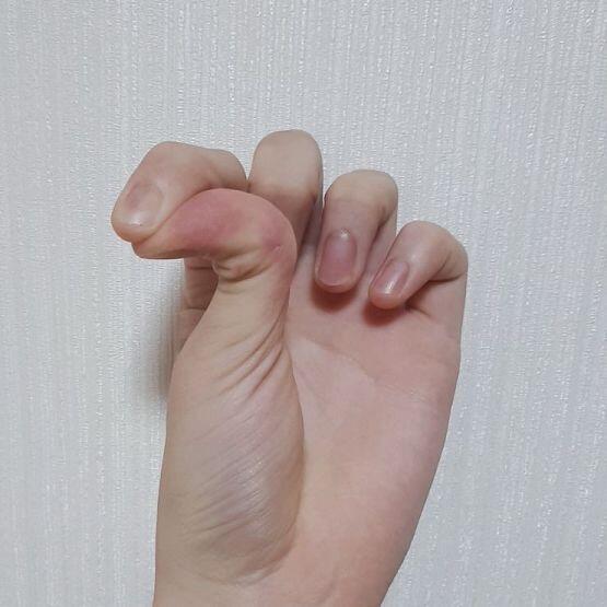 짠 나 엄지손가락 뒤로 많이 꺽을수 있다! 신기하지!! 아는 사람중 나만 되는 신기한 손가락!! 그리고 귀 뒤에 뼈가 튀어나온게 있음
