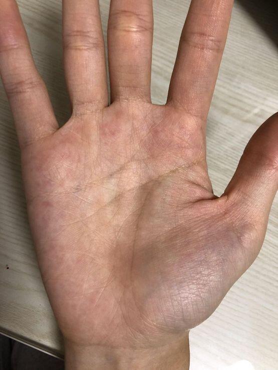 오른손입니답다바닫