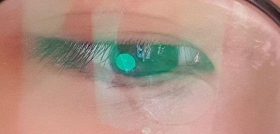 ㆍ