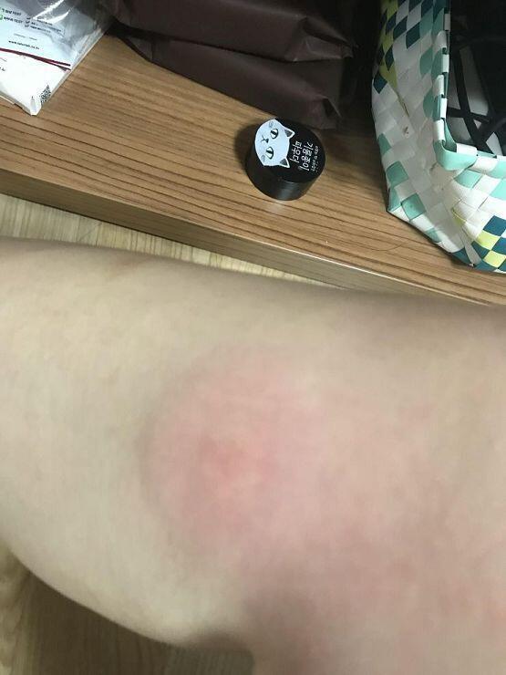 다리에... 이ㅓ 모지