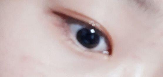나 14인데 나중에 눈 성형 꼭 할거야,,,존못탱