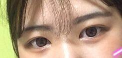 1. 180 정도.? ( 앞트임+눈매교정+쌍수절개법 ) 2. 난 부분마취로 했는데 아프긴 한데 죽을 정돈 절대 아니고 참을만해.. 의사쌤도 그렇