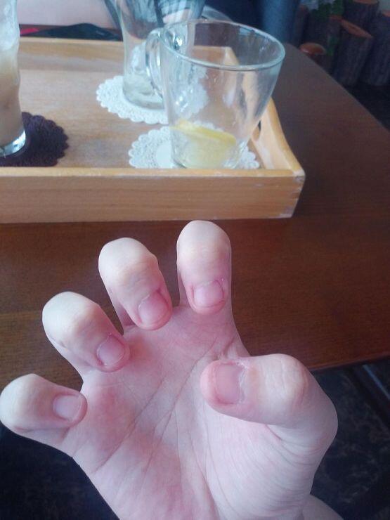 친구하고 친구동생하고 카페 갔었다 찍은 손톱. 음...가끔 입으로 가져가긴 했는데 너무 짧아서 물어뜯을게 없었어.