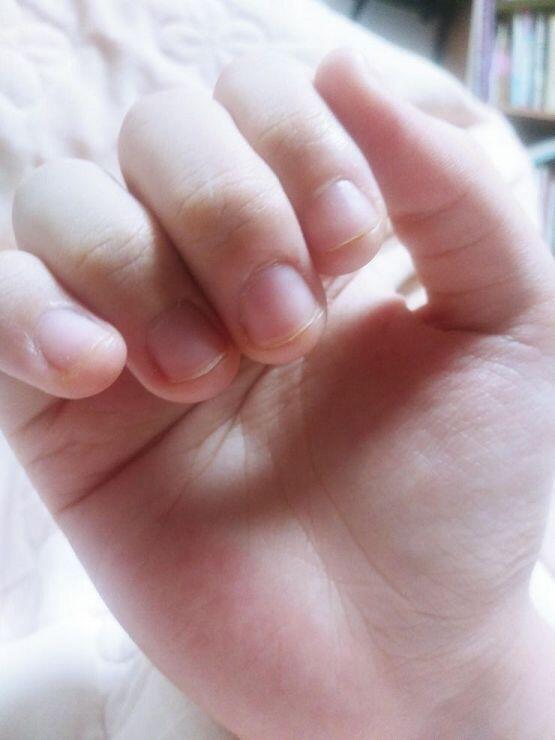 쪼오끔!이지만 자란 거 티 나지? 😊 또 한 명이 추천 눌러 줬네...고마워 고마워 힘이 난다! 열심히 맛난 걸 먹어서 손톱을 잘 길러야겠어 히