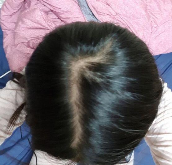 진짜 너무 심각한거같아...