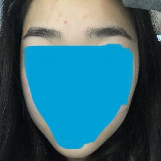 여드름은 이해해줘..ㅎ