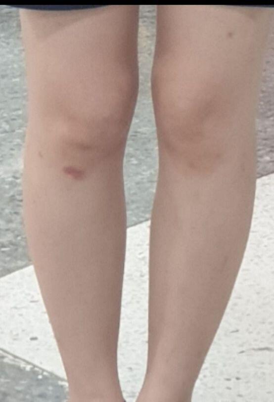 ㆍ