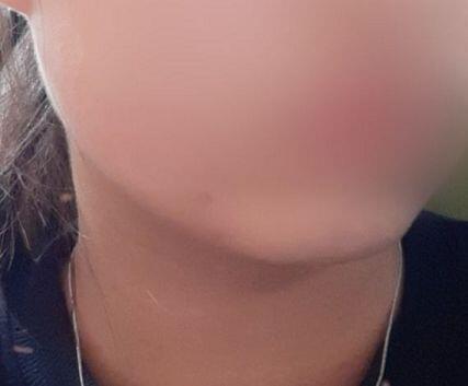 왼쪽 사선으로 돌면 턱이 저래보여ㅠㅜ왜지 혹시 무턱인가,.?