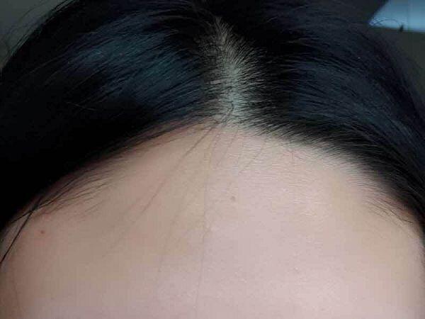 저런 짧은 머리 잡초같은애들