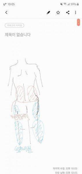 레주야 나 현재 미대생인데 꼬리뼈쪽 아리고 쑤시지? 너무 심하면 일단 병원가봐. 나도 방치하다가 일이 커져서 결국 근육 주사 6개 맞고 물리치료