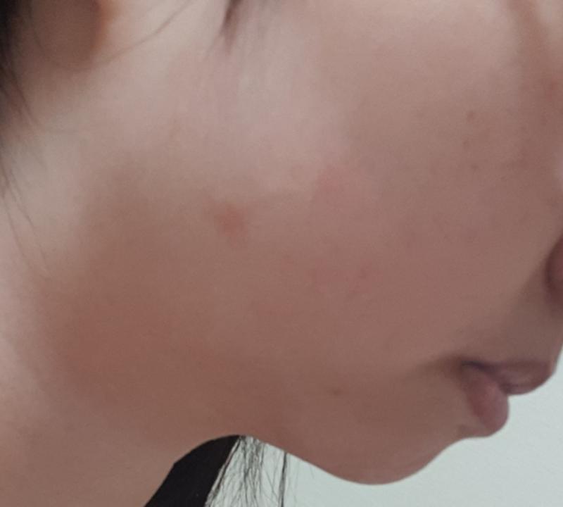 참새부리 입같음 참고로 엄마도 그렇고 할머니도 그렇다ㅜ