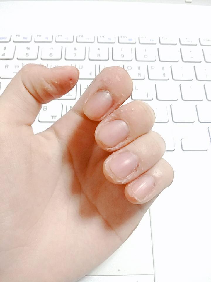 지금 손 모습이야.