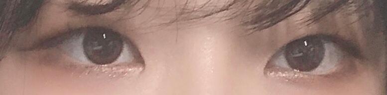 쌍액 안했을 때랑 했을 때! 주변에 속눈썹 붙이고 다니냐는 소리 들을 정도로 속눈썹이 긴게 장점이라 아무래도 쌍수 하는게 나을 것 같아...ㅠㅠ