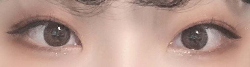 쌍액 안했을 때랑 했을 때! 주변에 속눈썹 붙이고 다니냐는 소리 들을 정도로 속눈썹이 긴게 장점이라 아무래도 쌍수 하는게 나을 것 같아...ㅠㅠ