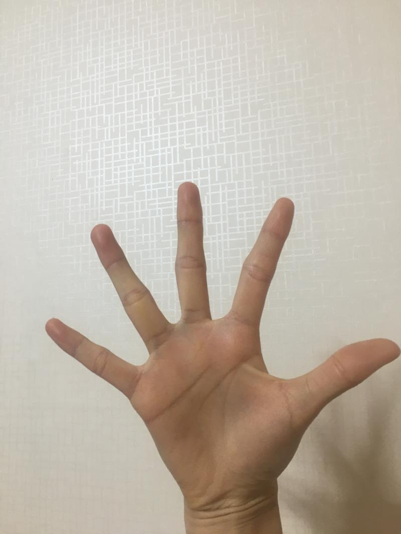 와 나도ㅠㅠㅠ 난 애들이 마녀손이라고 징그럽다고 놀려..ㅠㅠ