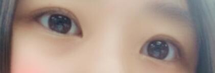 뿅