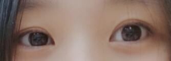 스레주 눈 하나 더ㅎㅎ