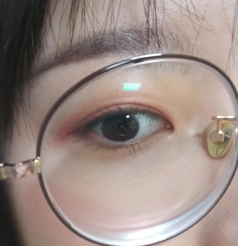 완전 데일리 빨리 라식하고싶다