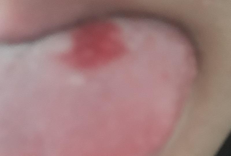 ㅠㅠ