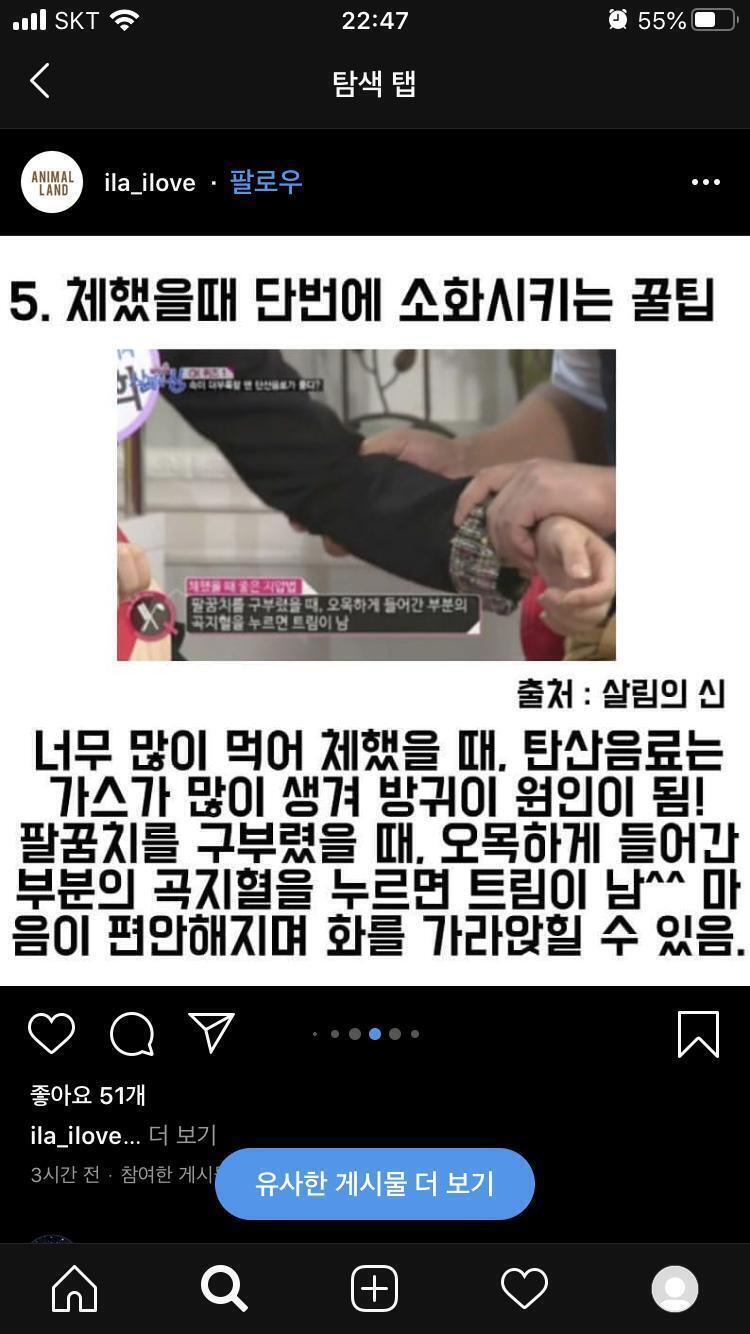 이거해봐!! 해본적없어서 효과가 있는지는 모르겠다ㅜㅜㅜ 정 안되면 가스활명수라도 사먹어!!