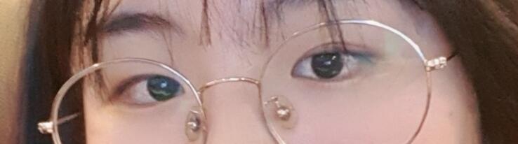 이게 수술전 사진. 좀 부끄럽네ㅎㅎ. 원래 눈은 양쪽다 속쌍커풀임. 근데 보면 오른쪽 눈이 더 커서 쌍커풀도 비교적 잘보임. 이런식으로 짝짝이가
