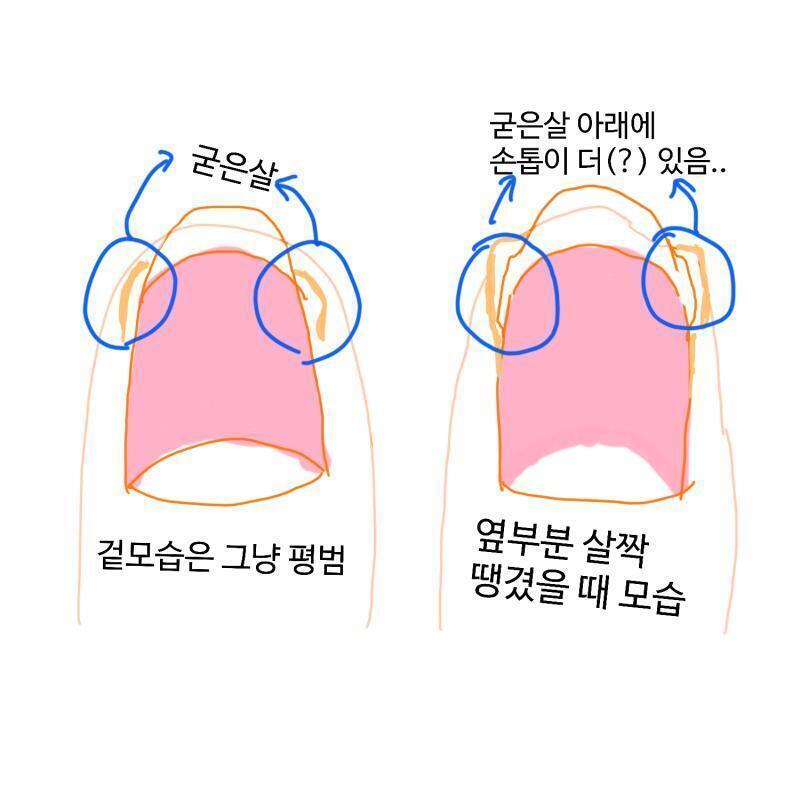 >>19 내성손톱까진 아닌거같아 손톱이 살 안으로 파고 들었다는 느낌은 아니야! 괜히 손 사진 올렸다가 알아볼까봐 쫄려서ㅜㅜㅜㅜ 미안해ㅜㅜ