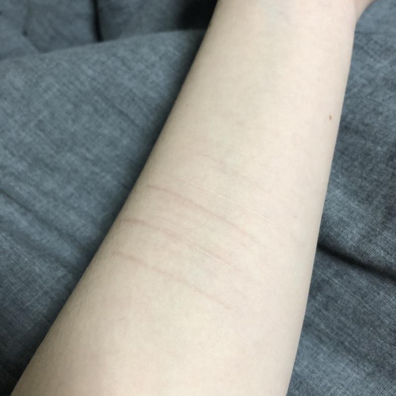 이건 선생님하고 있었던 일 때문에 했던 자해 흉터야. 사진 상엔 잡히지 않는 옅은 흉터도 정말 많아...