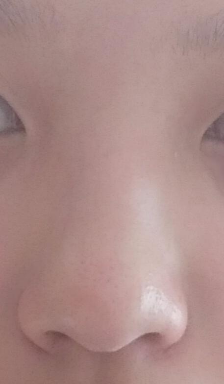 평가좀해줘.. 코가 낮다든가 뭉툭하다든가