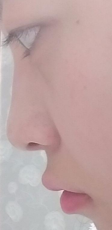 평가좀해줘.. 코가 낮다든가 뭉툭하다든가