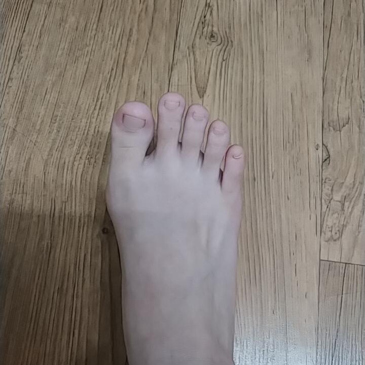 스레주 내 특기 어떻게 알았냐 나 발가락 벌리기 개잘함 (사진 쫌 징그러울 수 있음)