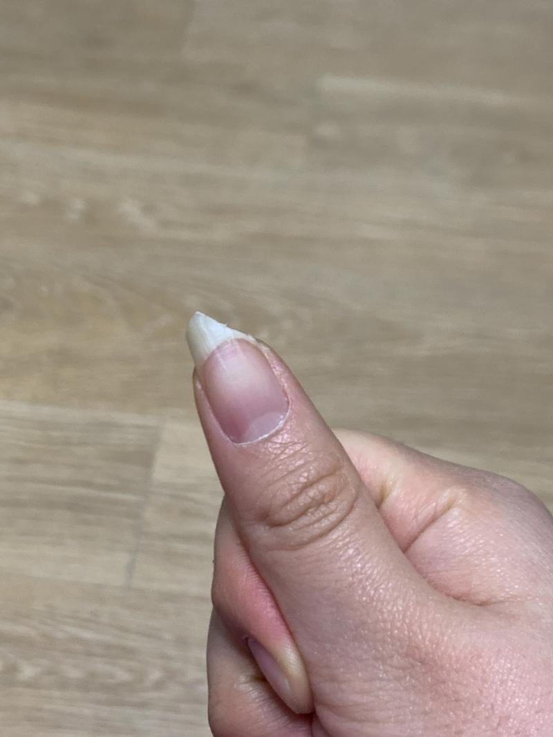 아니.. 요며칠간 손톱이 이상해서 가지고 놀다가 손톱이 깨졌어.. 이 손가락말고도 알바하다가 깨졌어. 근데 알바 끝나고 알았다지..? 그냥 손톱