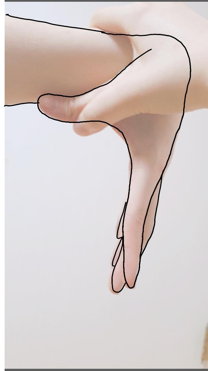 >>53 그리고 요것도! 이건 이해할랑가 모르겠는데 암튼 점선이 내 왼손. 쉬워보일지 모르겠는데 내 주변에 유일하게 나만 돼ㅋㅋㅋㅋㅋ