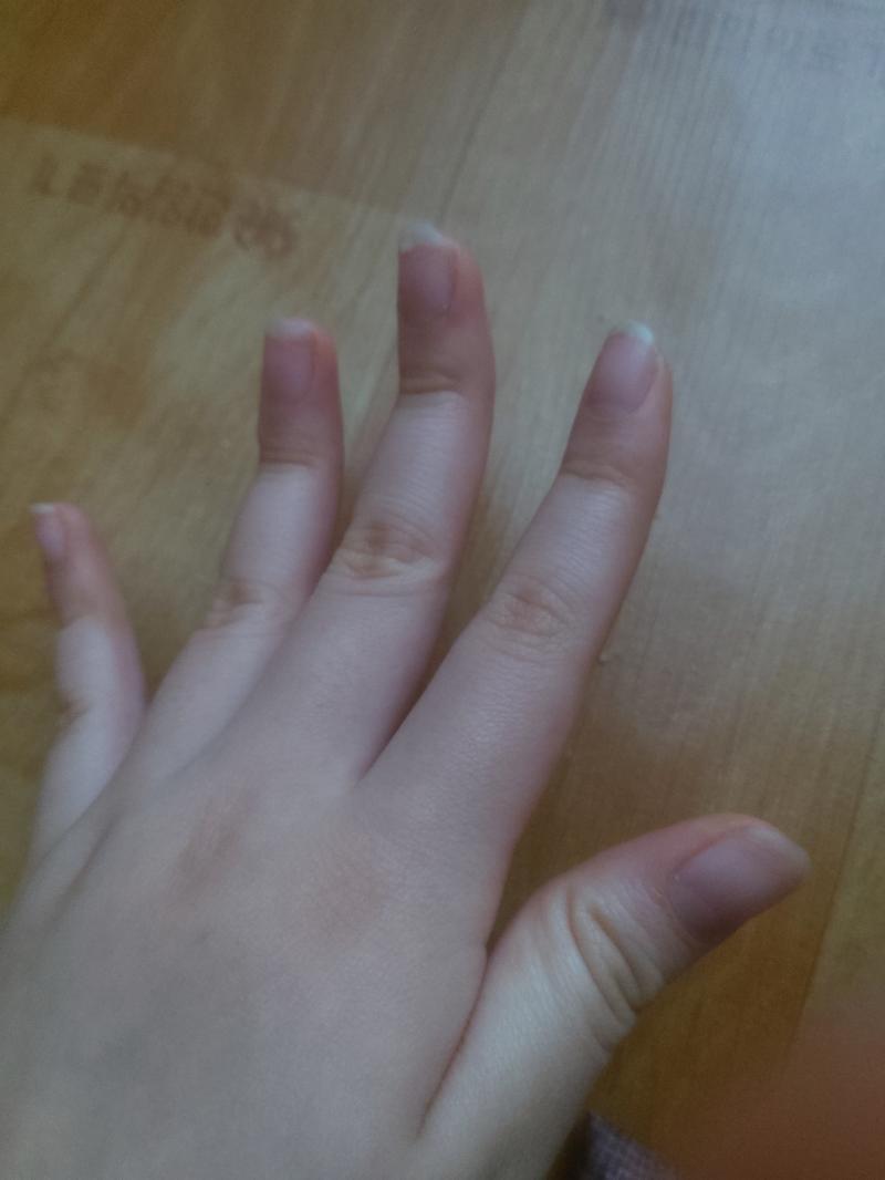 피부가 좋아! 발가락이 >>42 만큼 벌어져! 손가락이 좀 신기? 하게 생겼어