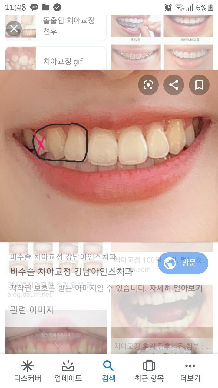 이해를 돕기 위해 사진도 올릴게. 검정색 테두리 안에 있는 이 3개가 그 흔들렸다는 애들이구(거울로 봤을때) 분홍색 ×표시가 빠졌다는 애야. 뺄