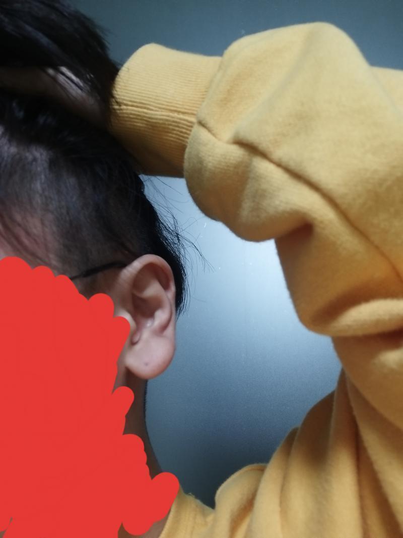 나 >>2인데 대머리는 아니지만 안쪽 머리 밀고 왔어!