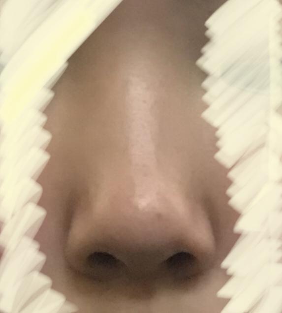 내 코야..