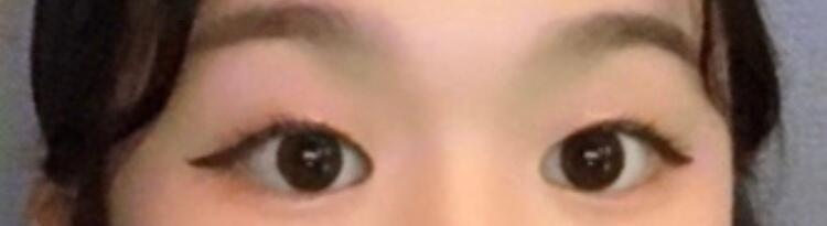 이고 내 데일리! 무쌍인데 넘 슬포뇸욤뇸 쌍수... 해야하나??...... 근데 여기서 친구만니면 좀 머쓱하겠다