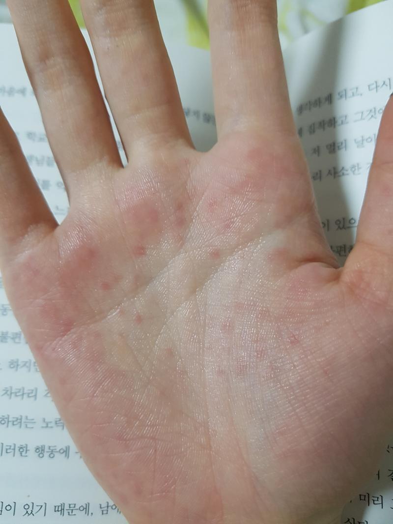 헐 아까 난 그대로 얼룩졌어...사진보다 더 많아